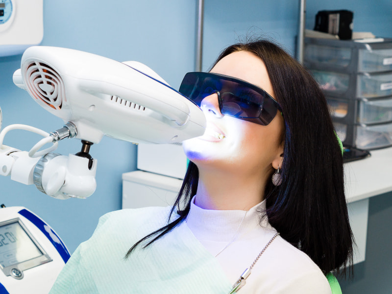 Professional teeth whitening